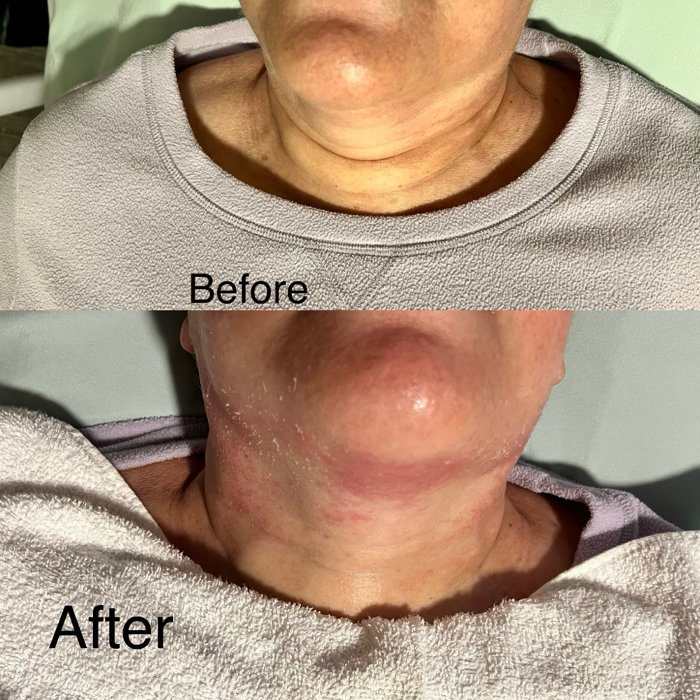 Body Scuplting 12 Session Deal