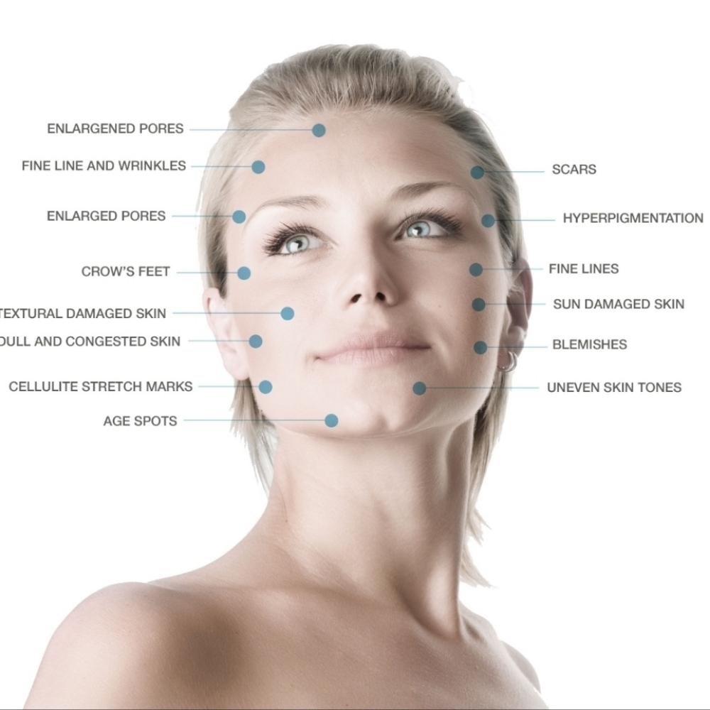 THE ULTIMATE FACIAL TREATMENT