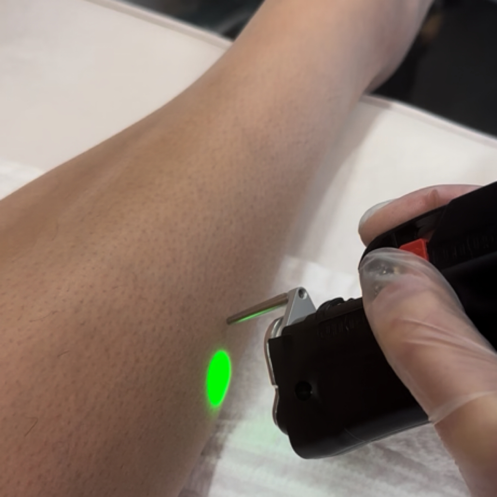 Laser hair removal - Full Legs. at Erika’s Beauty Lab in Littleton, CO