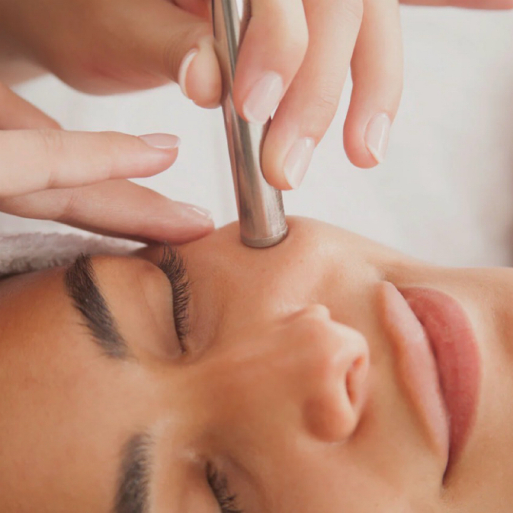 Diamond Microdermabrasion Add-On at “Illuminate” Skin By Mariah in St. Louis Park, MN