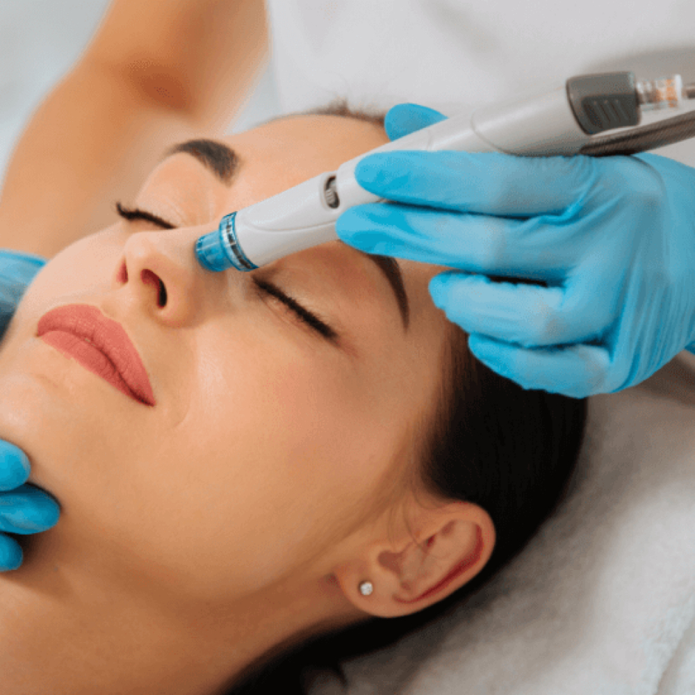 Advanced Skin Renewal Package at Brittney Murphy’s Skincare in Windsor, CO