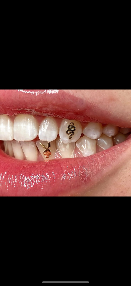 18k Gold Tooth Gems