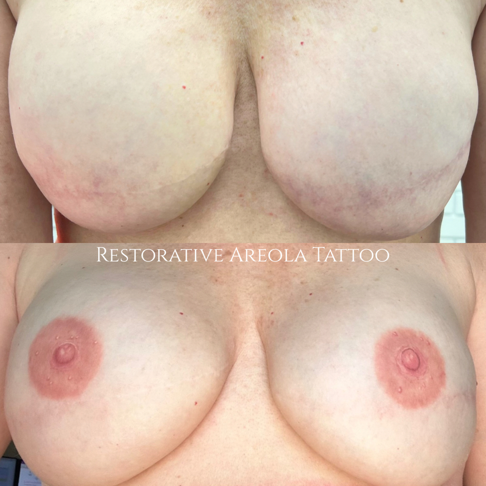 Areola Restoration at Meraki Hair Studio in Russellville, AR