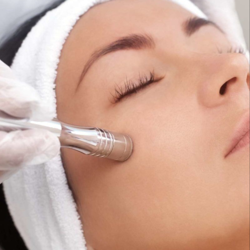 Microdermabrasion Facial at White Fern Head Spa & Skin Studio in Chattanooga, TN