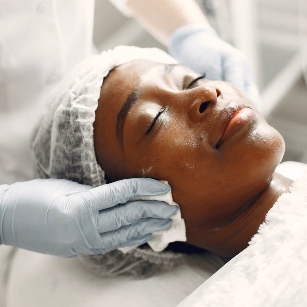 Level 1 Chemical Peel