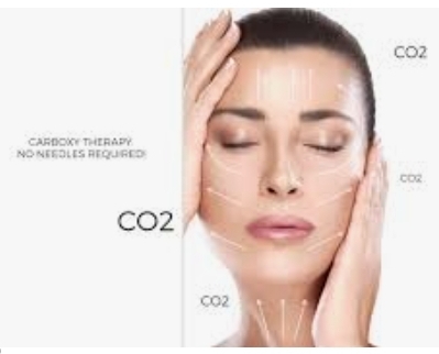 Dermaplane With CO2 Carboxy Therapy