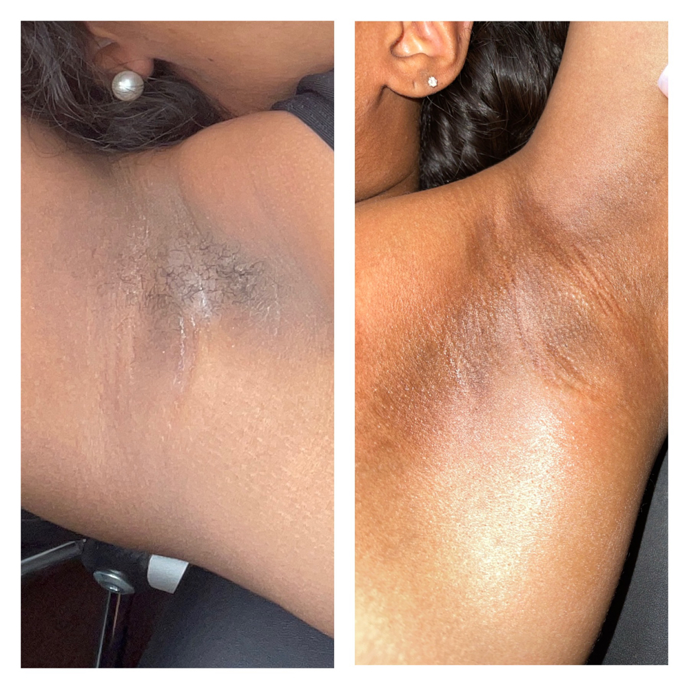 Under Arm Wax Service at ShadeMe Brows in Fayetteville, NC