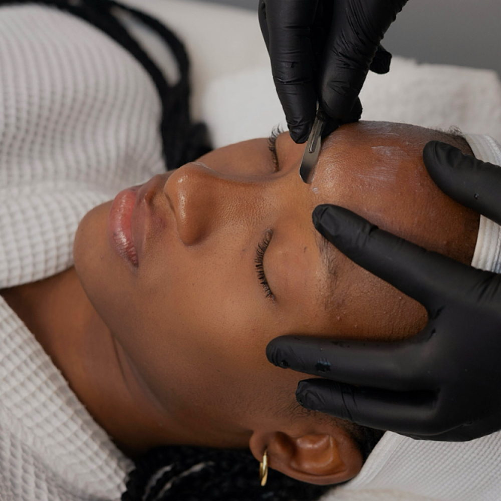 Dermaplaning at Valeria Esthetics in Stamford, CT