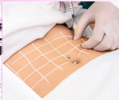 Doll Melt Refinement (Fat Dissolve)