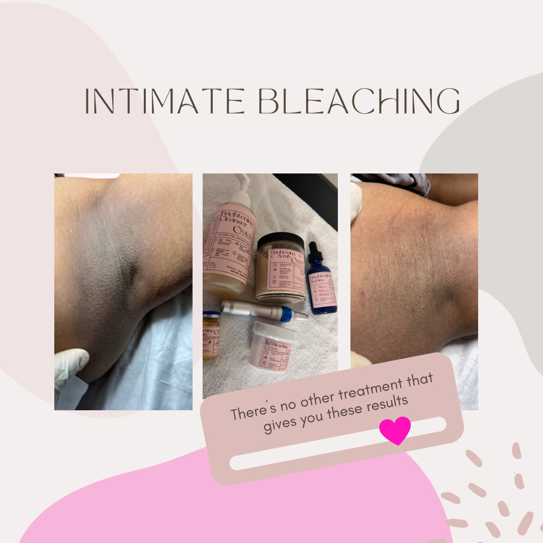 Underarm Bleaching
