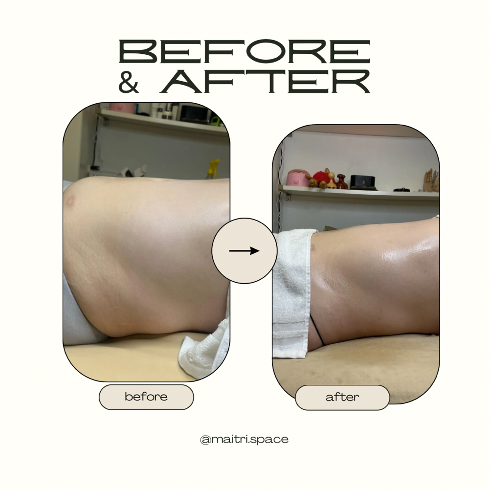 Body Sculpting- Abdomen