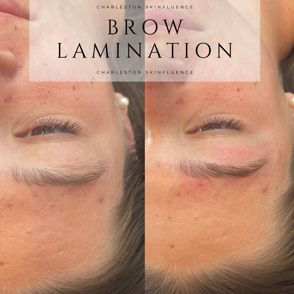 BROW LAMINATION