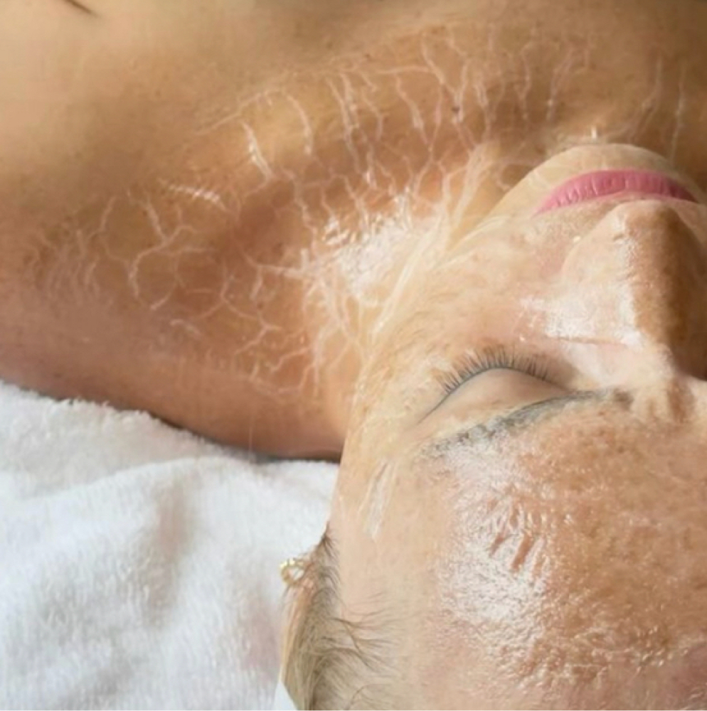 Enzyme Facial at Infinite Lash & Beauty Bar in Rochester, MN