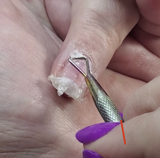 Product Removal