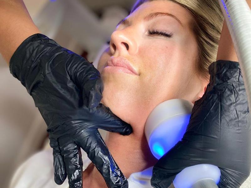 BOOK Cryoskin Facial Appointment