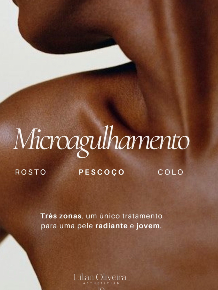Microneedling/microagulhamento $180