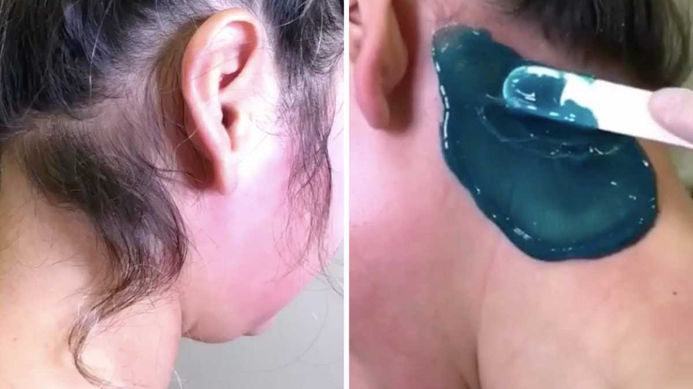 Neck Wax