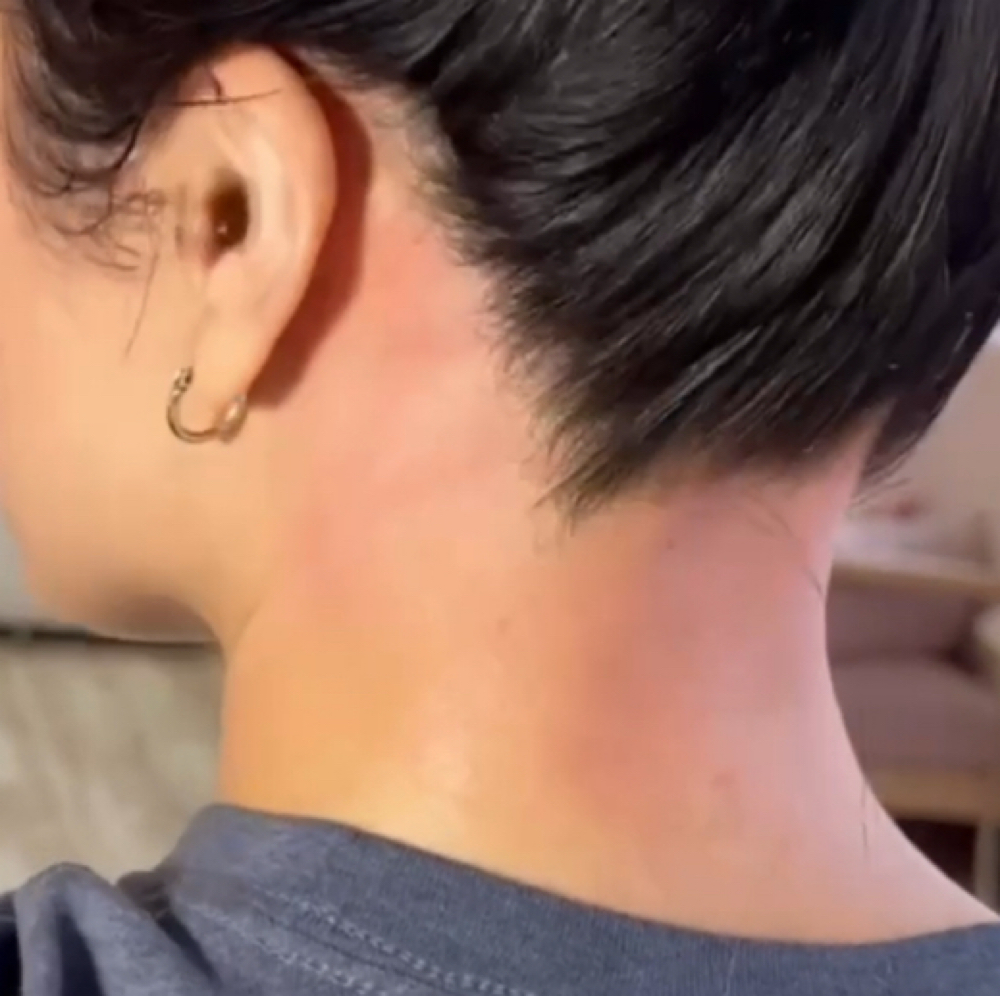 BACK NECK at Lakutis Skin Therapy in Houston, TX