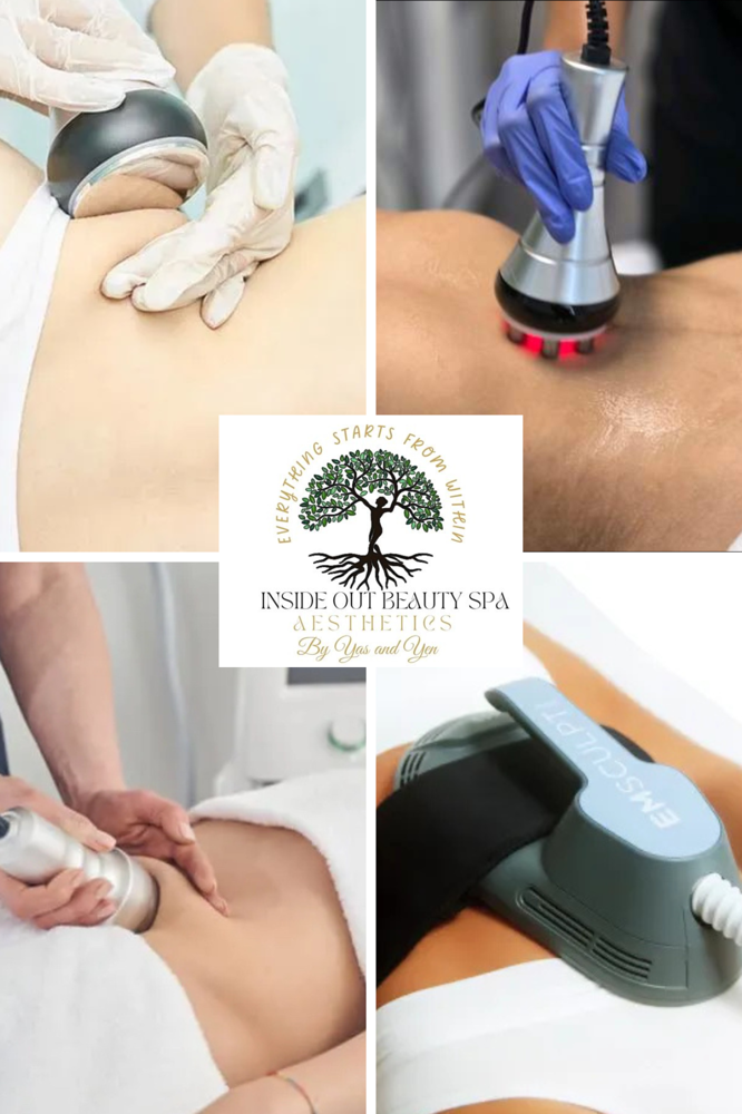 360 + Emsculpt (cavi,RF, Vac)