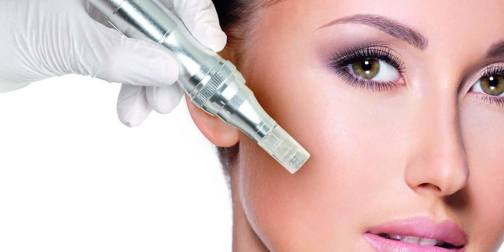 Microneedling Facial