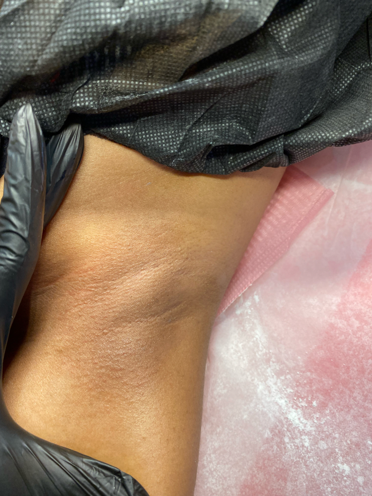 Under Arms Wax