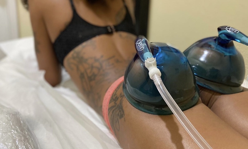 6 Butt Enhancement Sessions