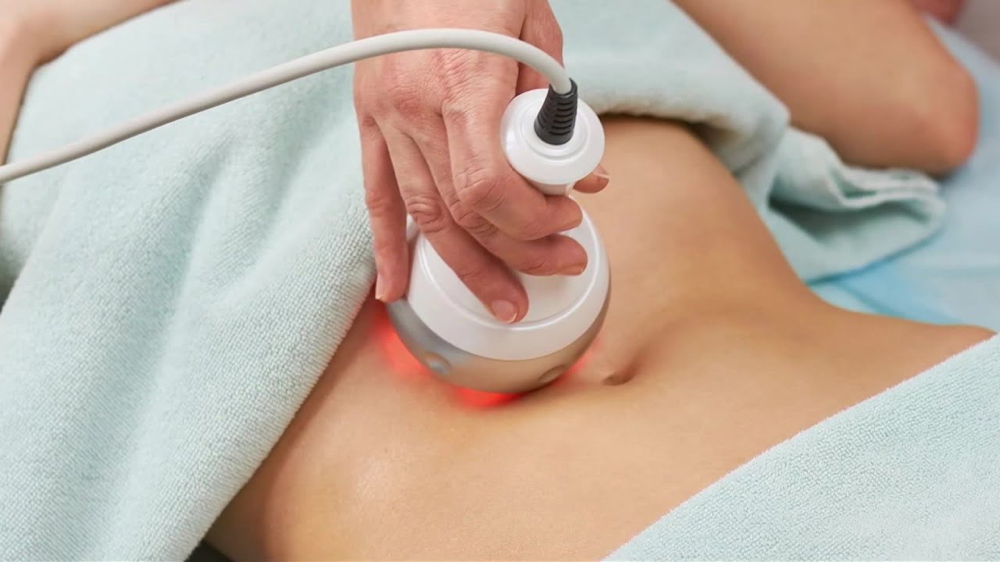 Full Body Lipo And RF Tightening