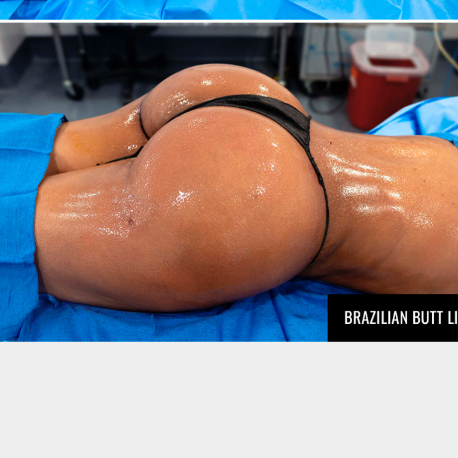 Post -Op Lymphatic Massage at Aesthetic Healing Massage in Minneapolis, MN