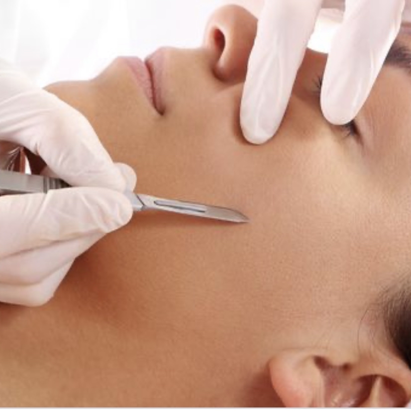 Dermaplane Treatment