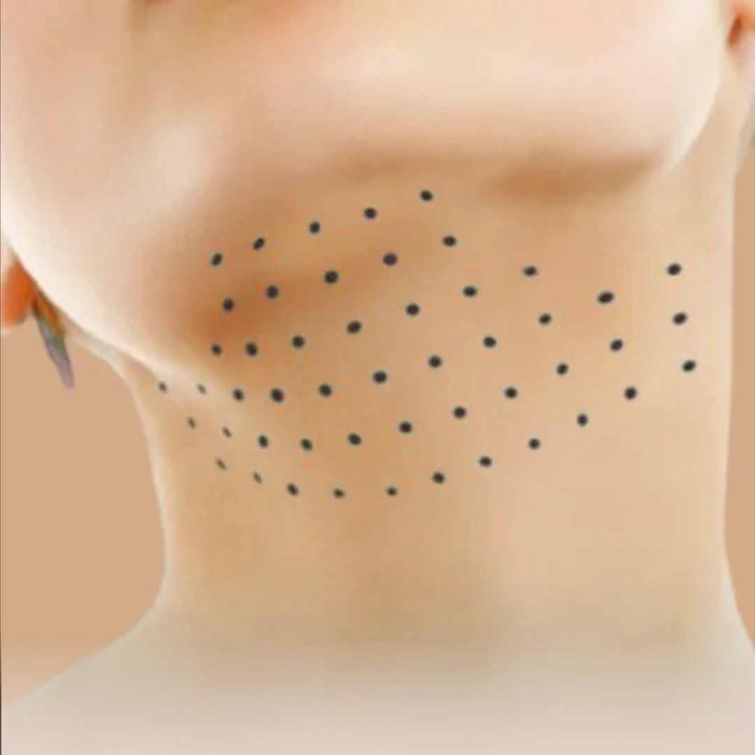 Double Chin Lipo Dissolve at Glow Lab Aesthetics & Wellness in El Paso, TX