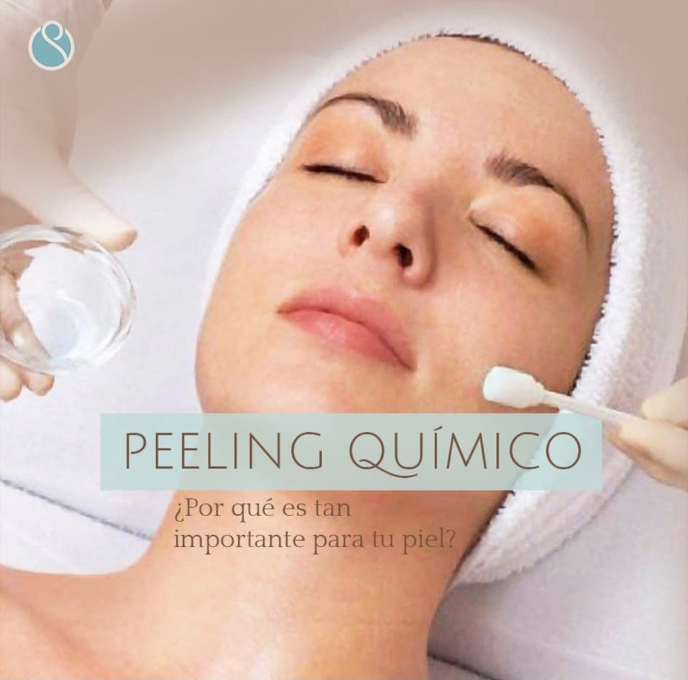 Peeling Quimico