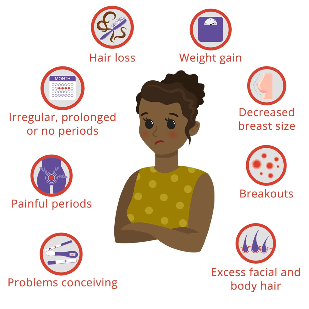 The Sophmore (PCOS)