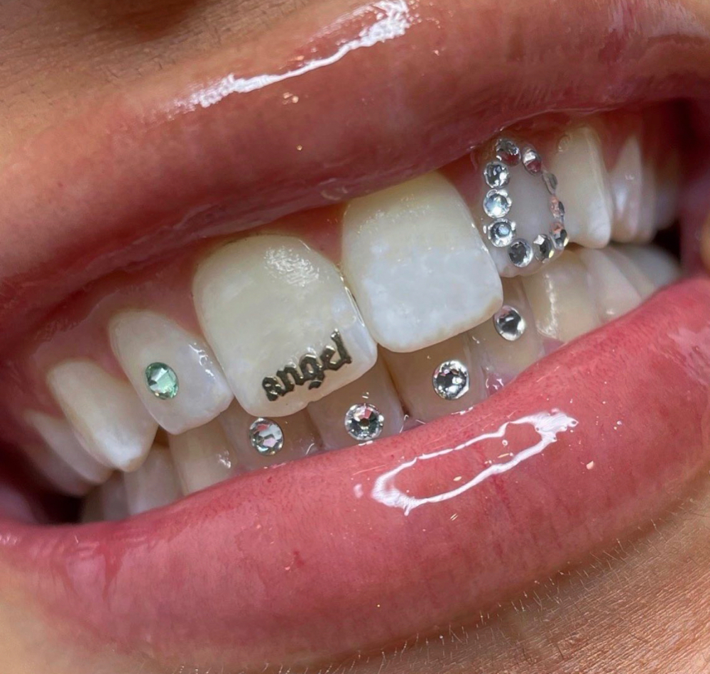 Custom Tooth Gem Design
