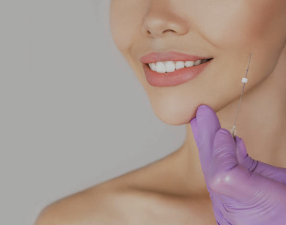 Masseter "Botox" (neurotoxin)