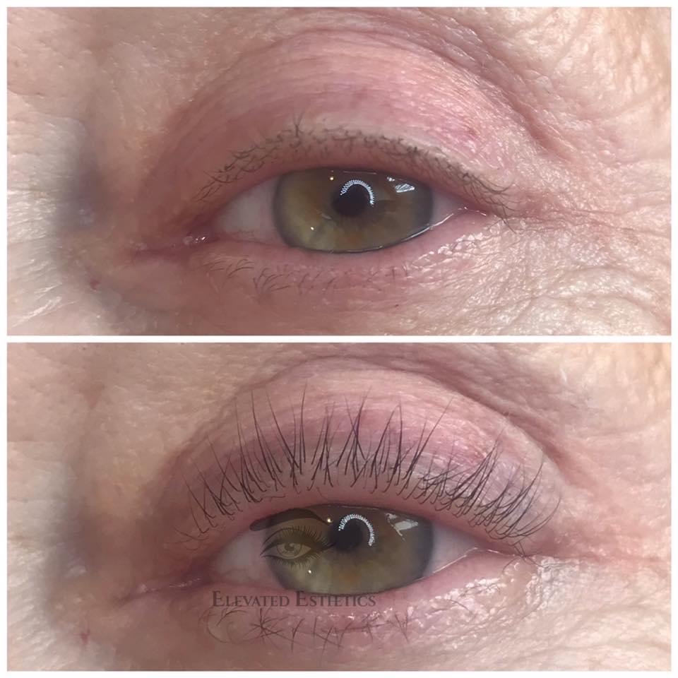 Lash Lift