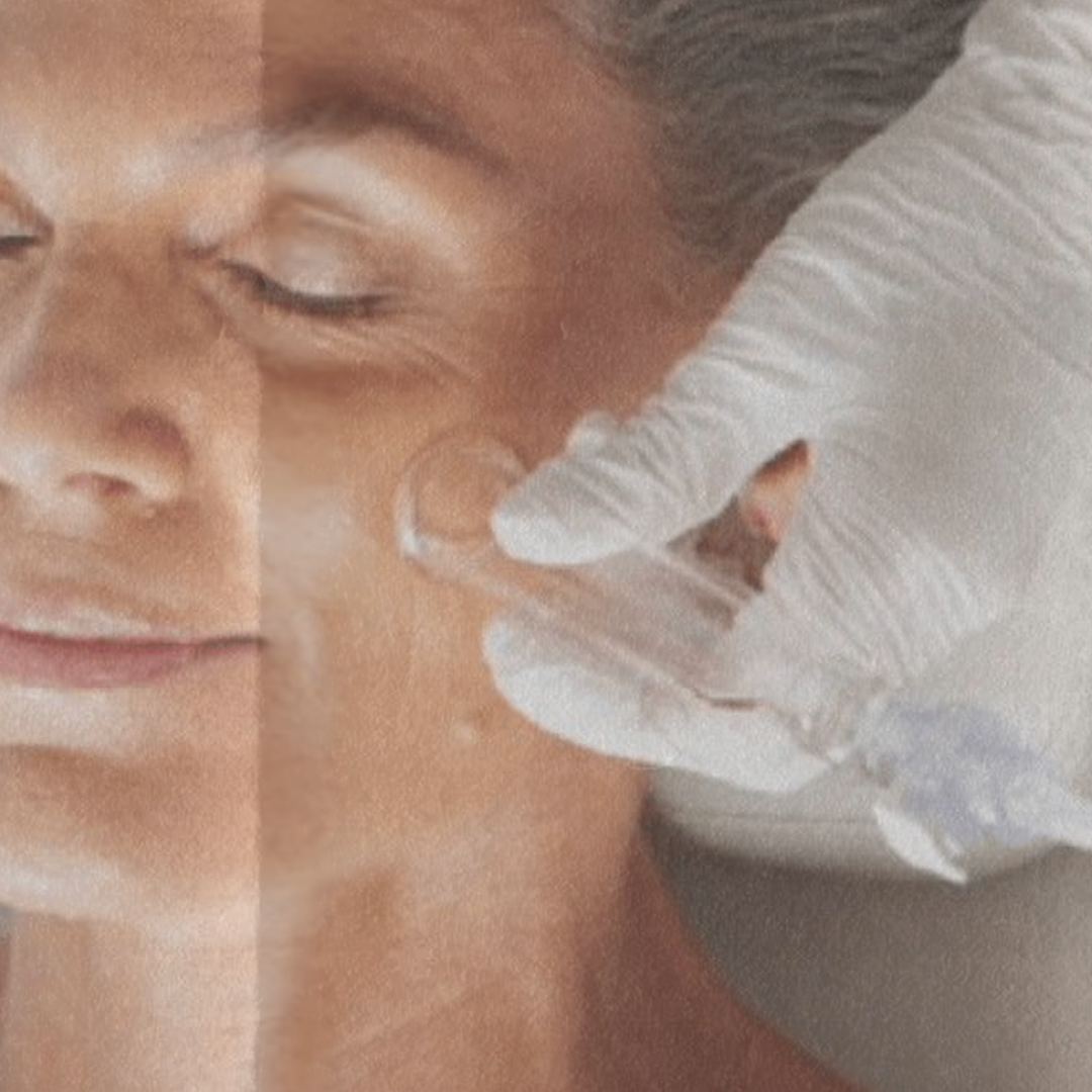 Facial Lymphatic Drainage
