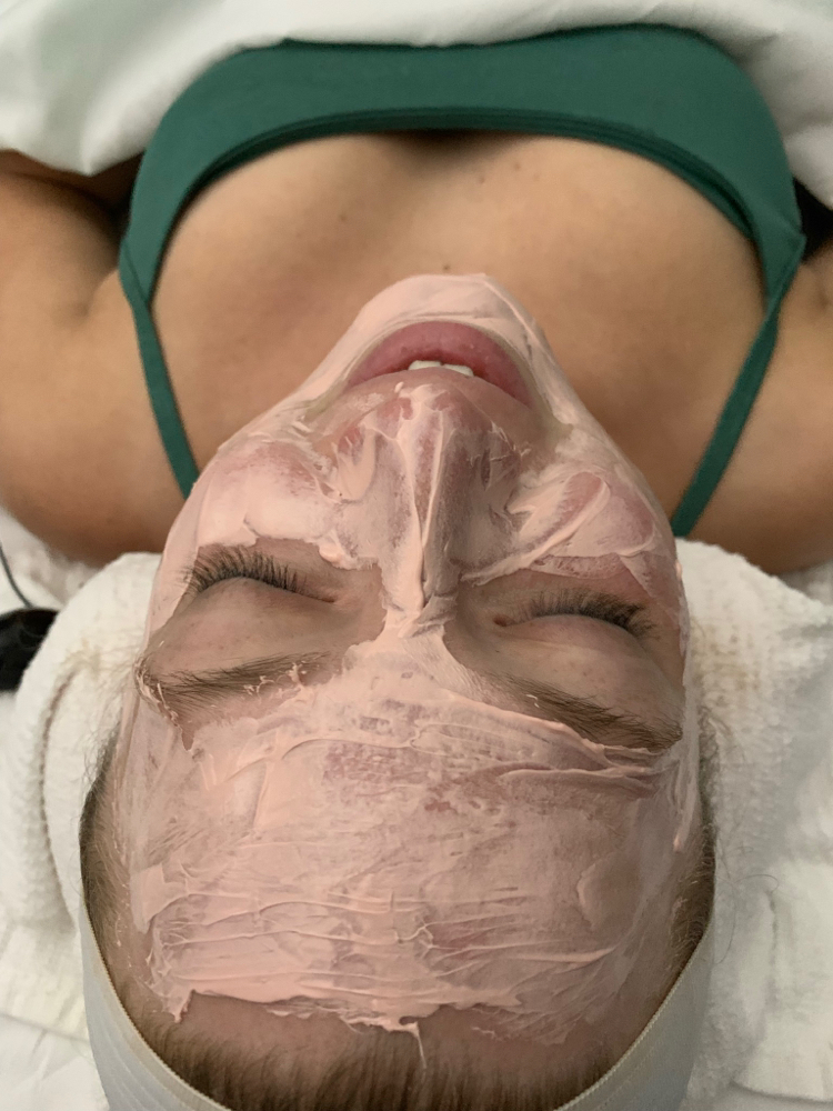 Vitamin C Facials