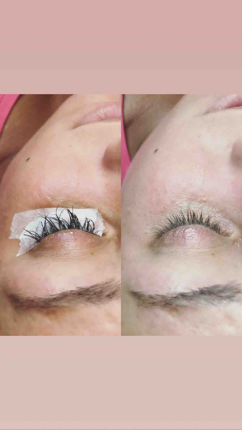 Eye Lash Removal