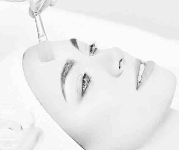 Chemical Peel