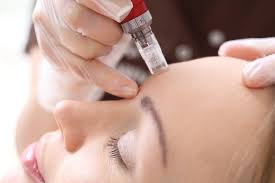 Microneedling Facial