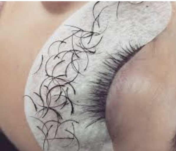 Lashes-Removal and Treatment