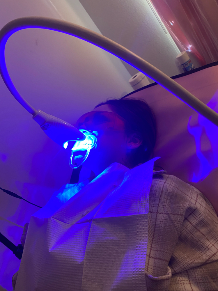 Teeth Whitening / 60 Min
