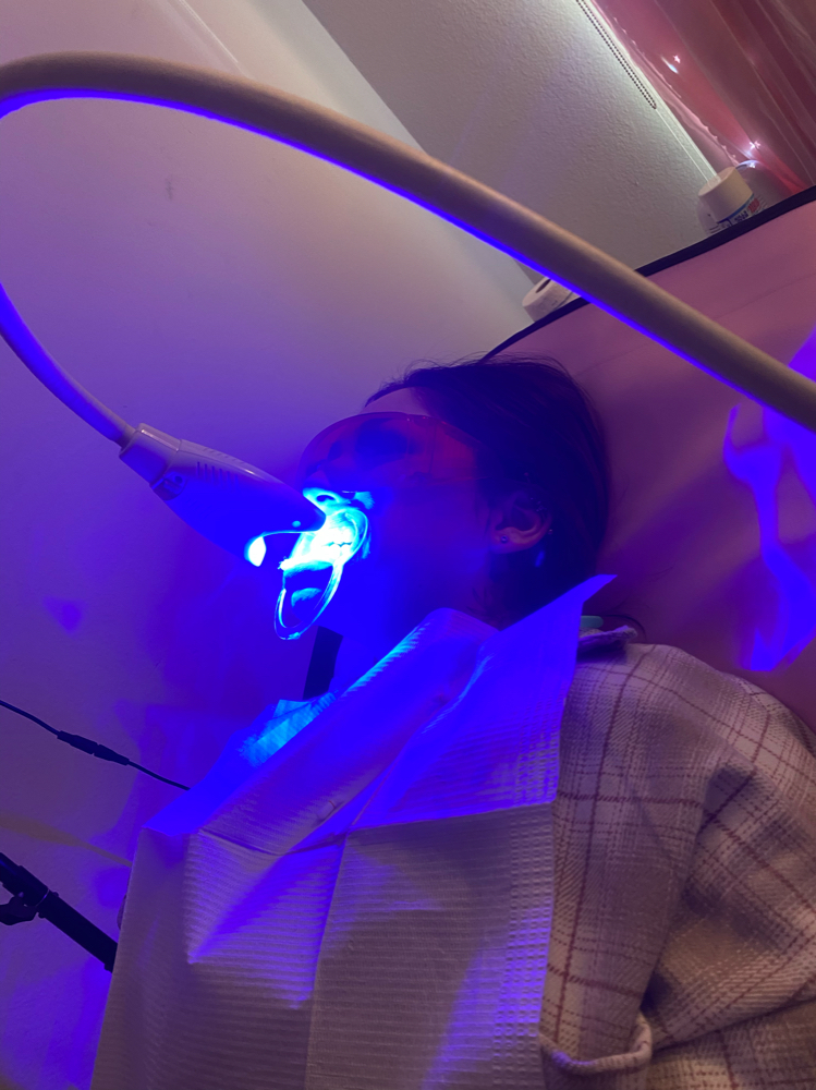 Teeth Whitening / 90 Mins