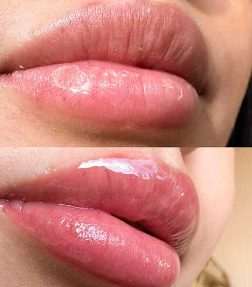 Lip Booster