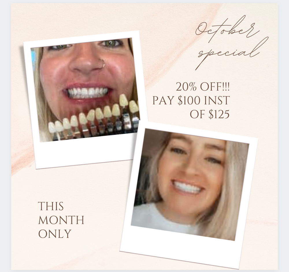 Teeth Whitening