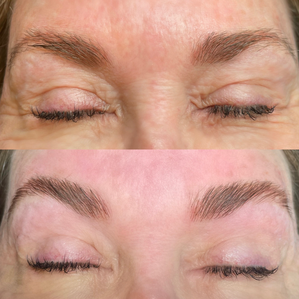 Brow Lamination