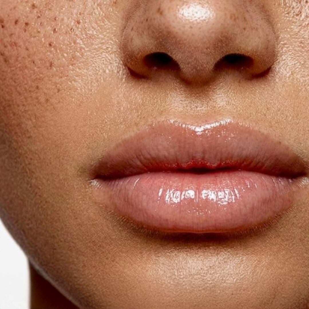Upper Lip Wax at Vital Aesthetics in Albert Lea, MN
