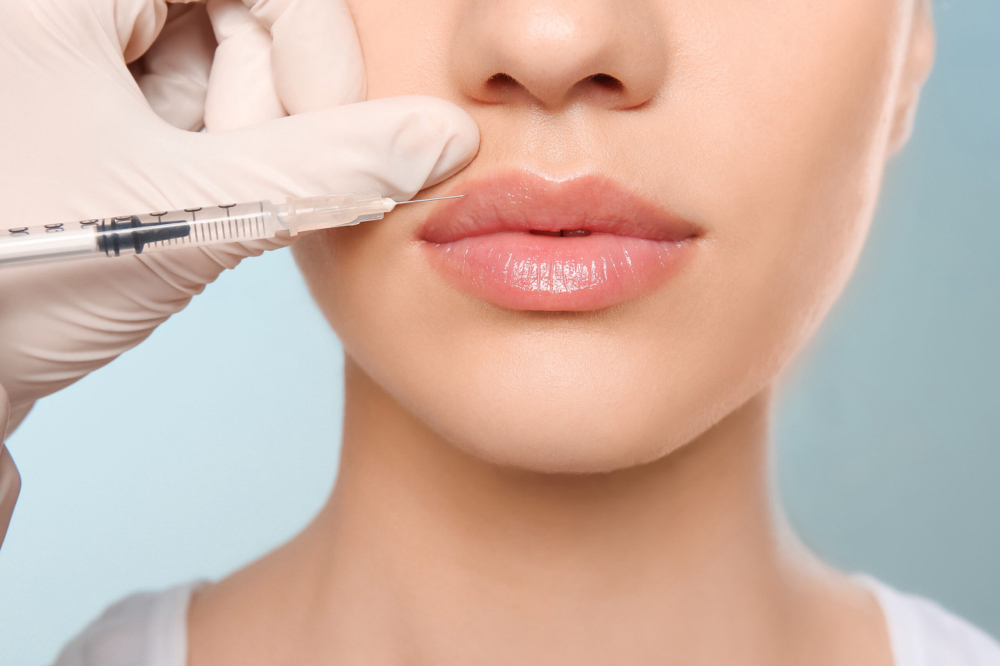 Lip Filler (Full Syringe)