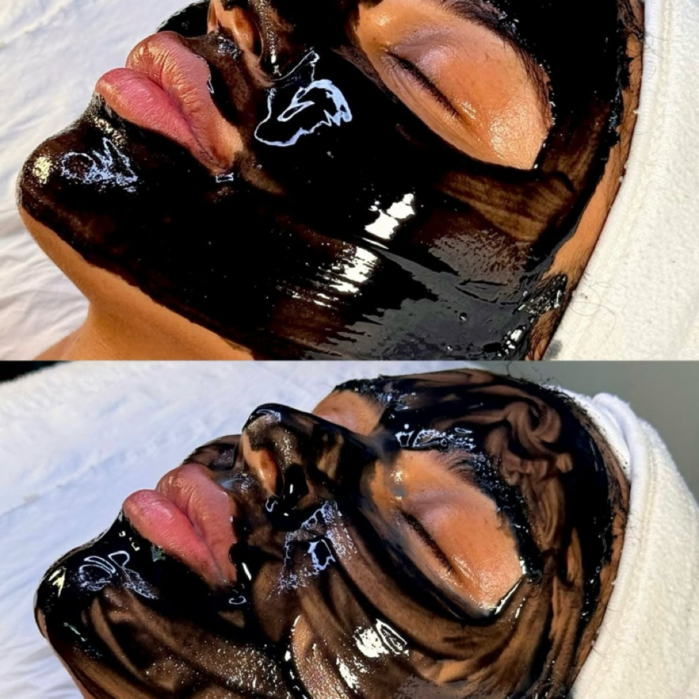 Acne Clarifying Facial at LucentSkin Facial Studio in Roswell, GA