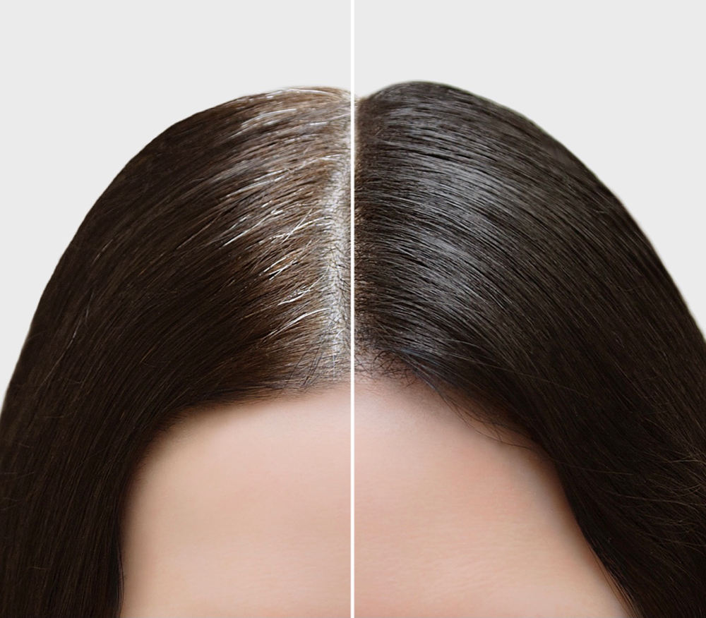 Hairline touch up